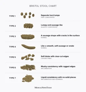 bristol stool chart image and descriptors